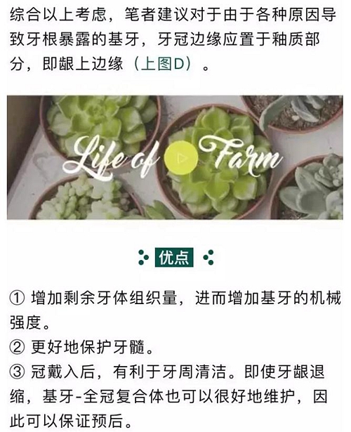 做全冠修复时基牙根面暴露，如何备牙？