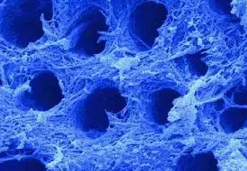 详细了解自酸蚀、全酸蚀