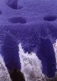 详细了解自酸蚀、全酸蚀