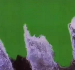 详细了解自酸蚀、全酸蚀